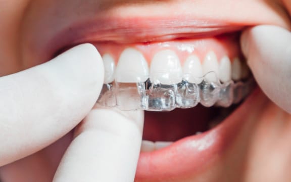 Treatment room where ClearCorrect aligners are provided at Tomlinson Dental