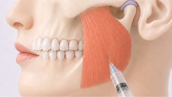 Illustration of facial muscle anatomy