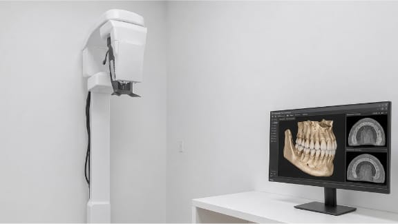 Cone beam CT imaging technology