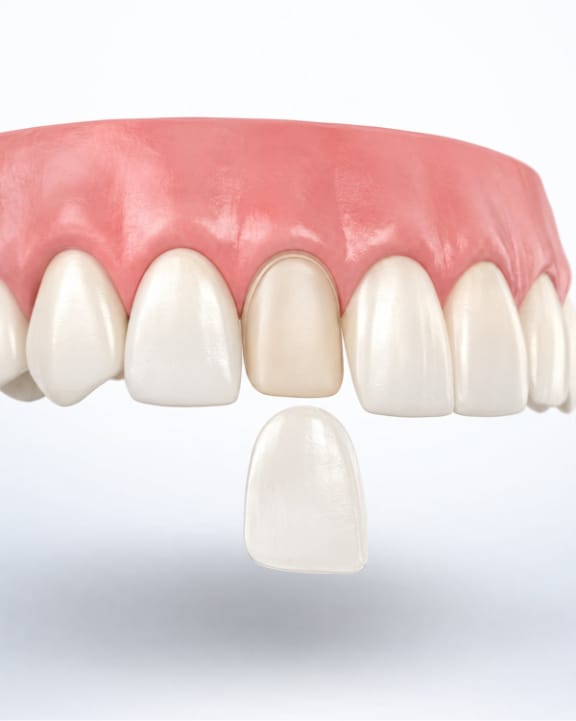 A patient admiring her new porcelain veneers at Tomlinson Dental in Tampa